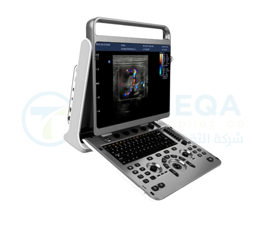 Chison Ultrasound EBit 30