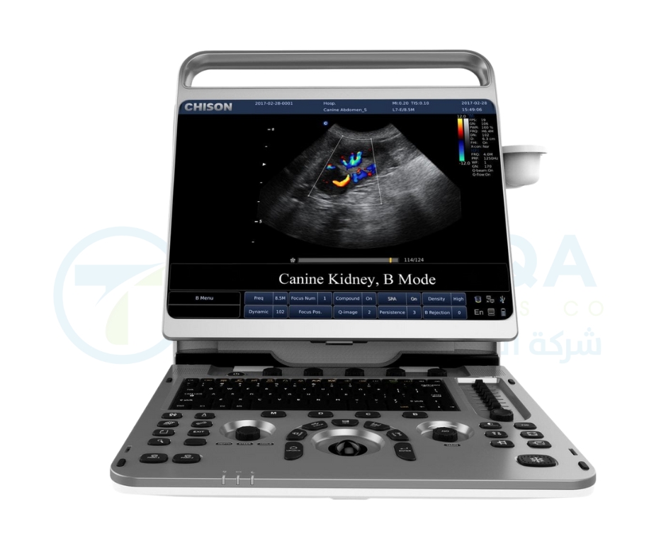 Chison Ultrasound EBit 50