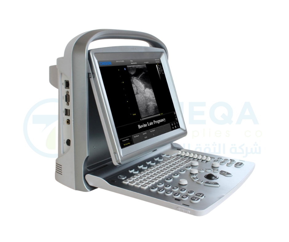 Chison Ultrasound ECO 5