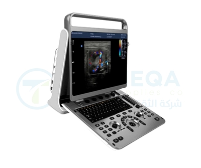 Chison Ultrasound EBit 30