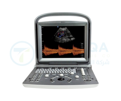 Chison Ultrasound ECO 6