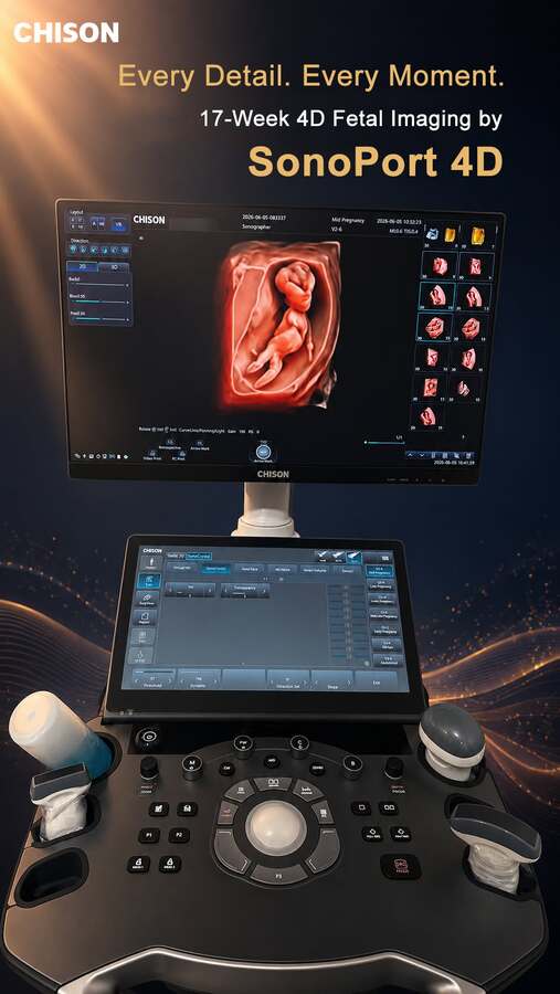 Chison Ultrasound SonoPort 8