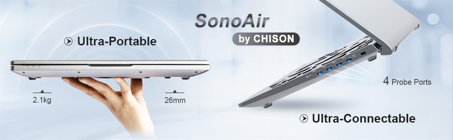 Chison Ultrasound SonoAir 30